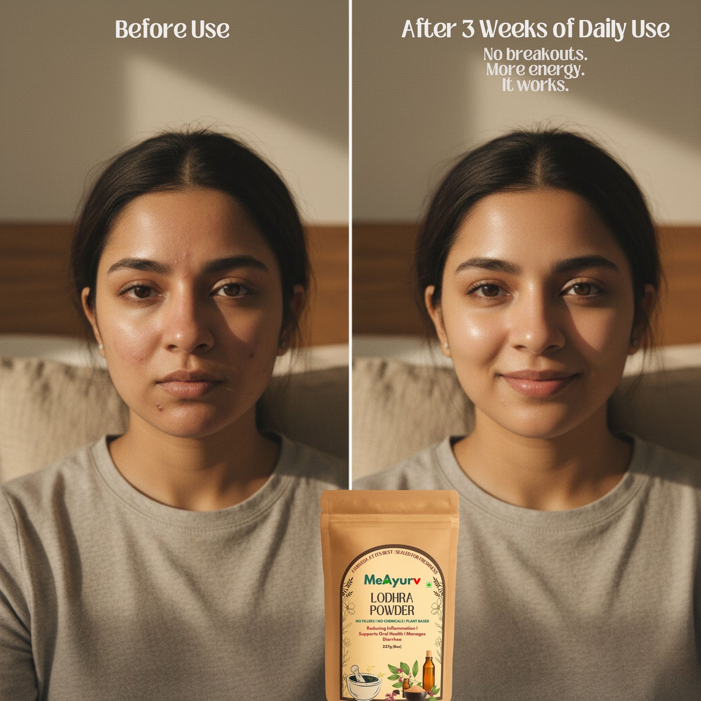 MeAyurv Organic Lodhra Powder – Pure Symplocos Bark | Ayurvedic Herbal Supplement for Skin Health & Hormonal Balance | Natural, Vegan, Chemical Free